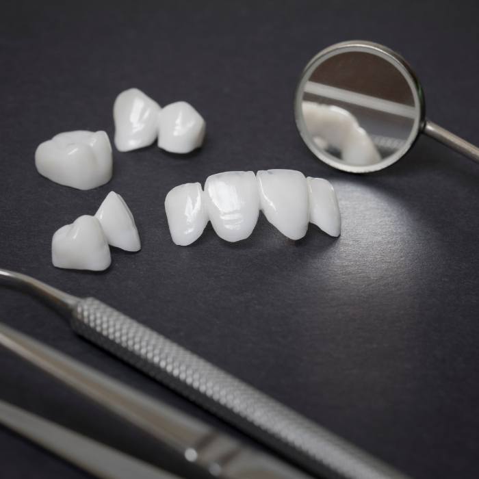 Several white dental crowns and veneers on table with dental mirrors