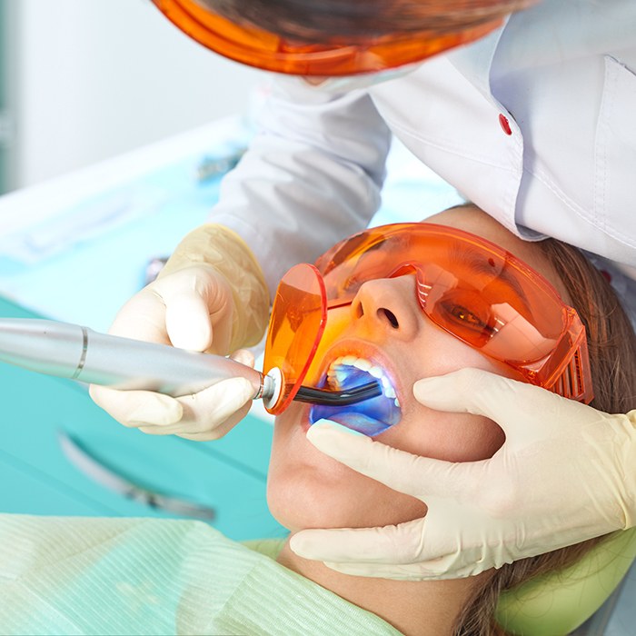 A dentist placing a woman’s tooth-colored fillings